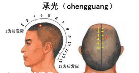 承光穴→治頭痛、鼻炎