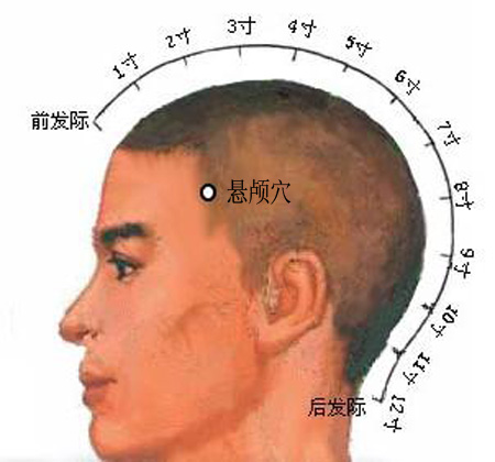 懸顱穴→治偏頭痛、面腫