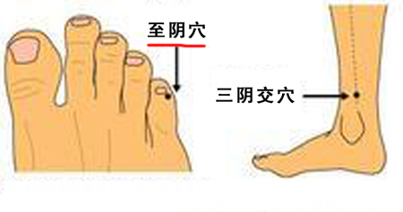 至陰穴→治頭痛、目痛