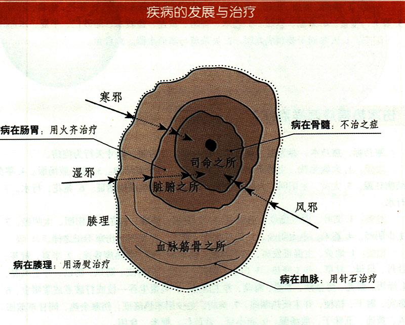 諸氣應(yīng)怎樣治療？