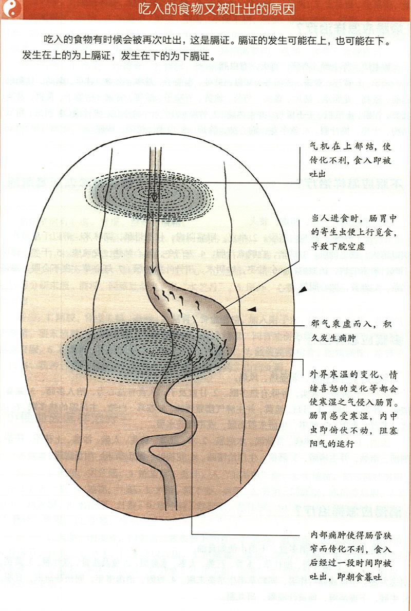 嘔吐應(yīng)怎樣治療？