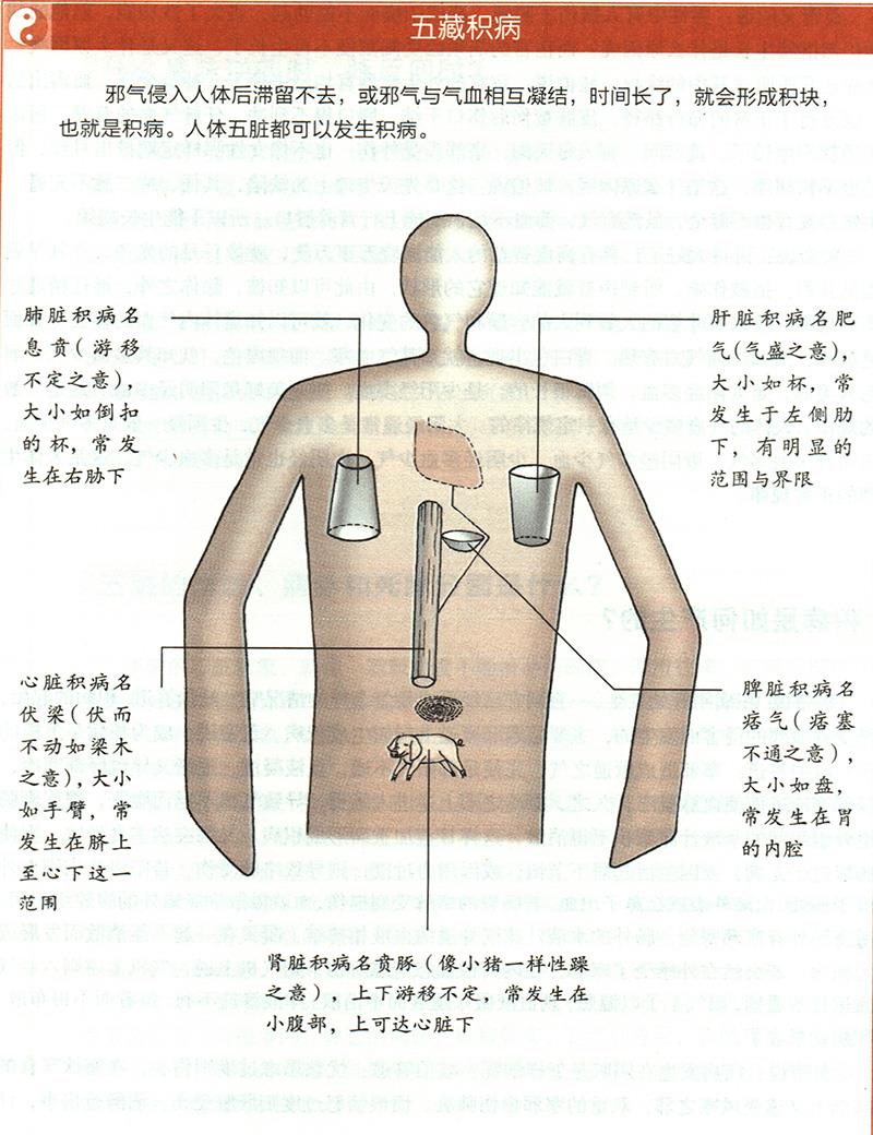 積病是如何產(chǎn)生的？